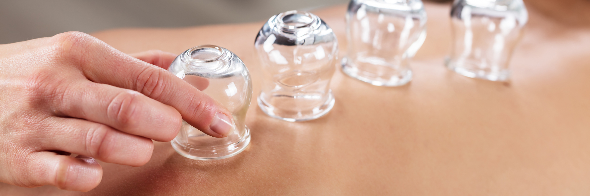 Cupping Therapy Using Vacuum Chinese Glass. Cup Massage