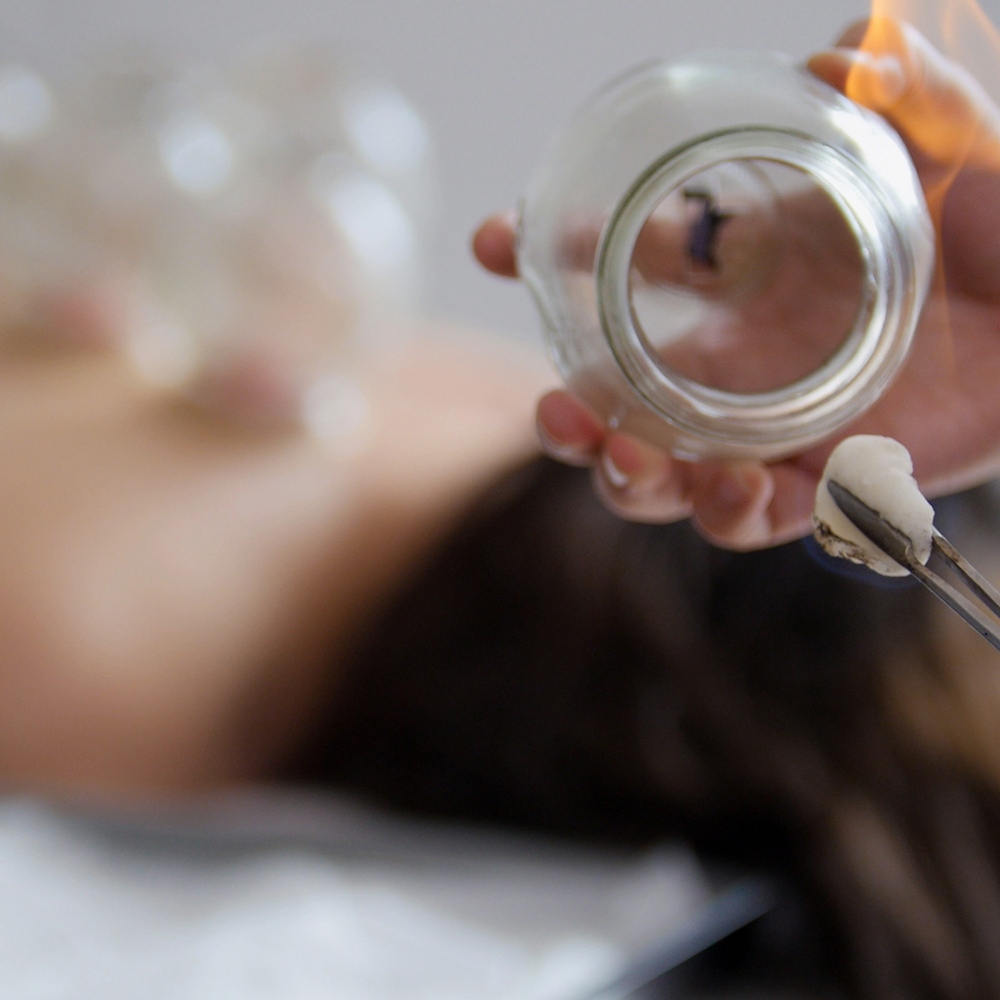 Doctor sets a medical glass cup on the back of a woman, physiotherapy, Tibetan medicine